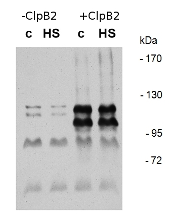 western blot using anti-ClpB2 antibodies